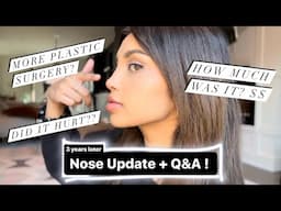 3 Year Nose Job (Rhinoplasty) Update + Q&A! - Famous Turkish Dr. Resit Burak Kayan