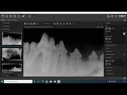 How to Use the Toolbox for Editing Dental X-Rays in the iM3 Software