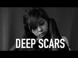 DEEP SCARS - Deep Emotional Piano Rap Beat