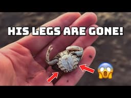 Cute Animal Lost its Legs! 😭