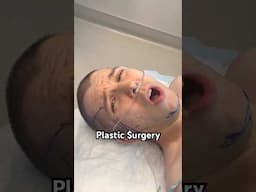 Plastic $urgery....Which gender?? 🤬