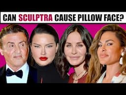 Can Sculptra Migrate and cause Pillow Face- What if I don't like my results?