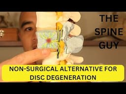 What is Basivertebral Nerve Ablation? A non-surgical alternative for Degenerative Disc Disease