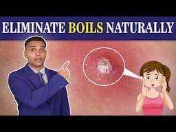 Say Goodbye To Painful Boils Forever | Ayurvedic Treatment And Remedies