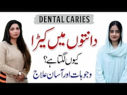 Dental Caries in Kids: Causes & Treatment You Need to Know - Dr Javeria Ahmad | Nutritionist