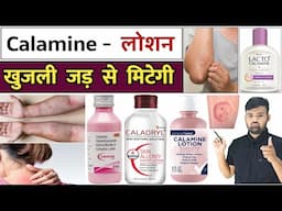 खुजली का इलाज | Calamine Lotion | Antifungal Cream | Treatment | Medicine | Pharmacy | Infection