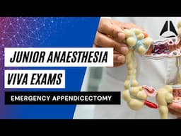 Emergency Appendicectomy | Junior Anaesthesia Vivas #anesthesiology #anesthesia #exampreparation