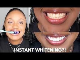 I INSTANTLY WHITENED MY TEETH IN 30 SECONDS USING HISMILE?! *Shocking Results*