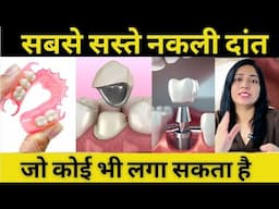 सबसे सस्ते और अच्छे नकली दांत कौनसे होते है ? Removable Partial Denture | Cheapest Artificial Teeth