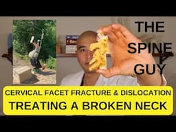 Treating A Broken Neck - Cervical Facet Fracture & Dislocation