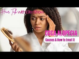 Dealing with CCCA Alopecia? Causes, Treatments & Hair Care Tips for Regrowth! Hair Talks with Elite